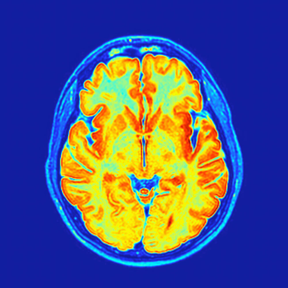 Is UVA getting smarter about how it plays its biotech research cards?