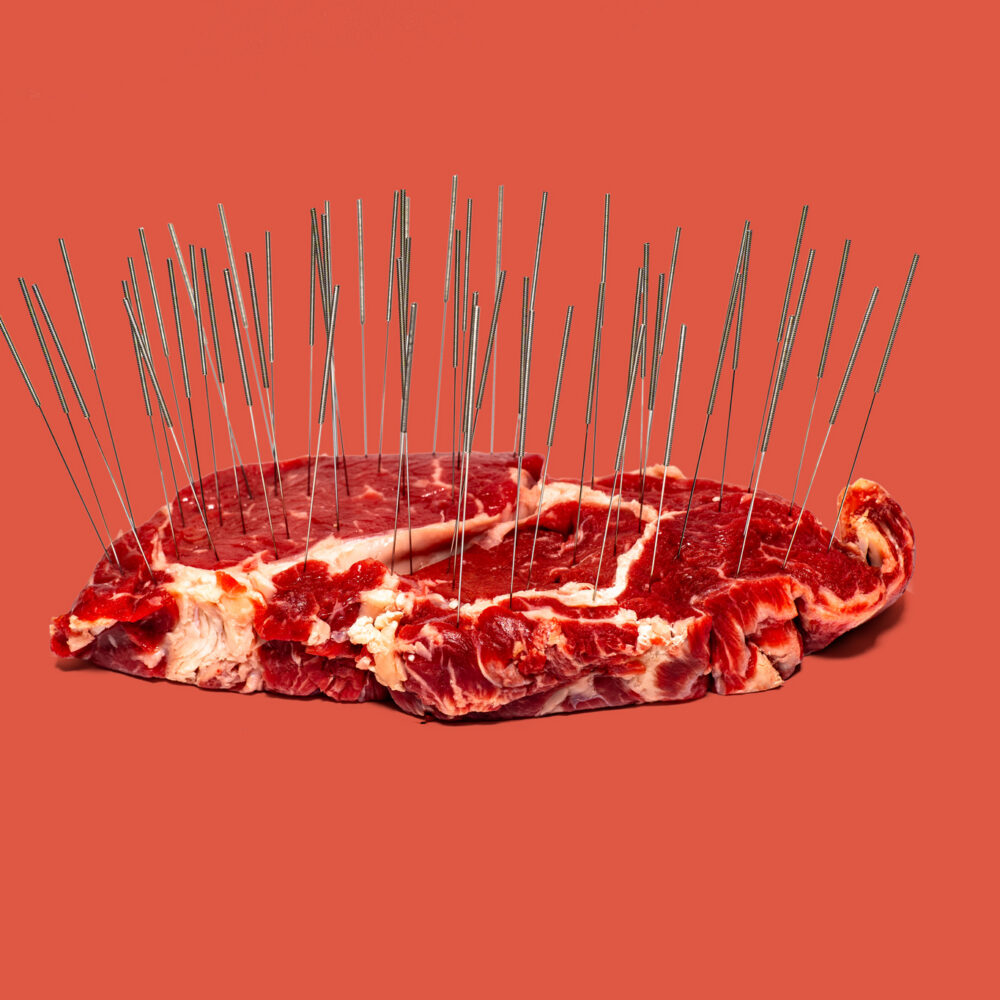Some Central Virginians with the red-meat allergy alpha-gal turn to acupuncture for symptom relief 
